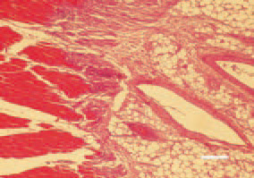 Fig. 5. At a later stage, a substitution
of atrophied fibres by adipose tissue
could be detected. H/E, Bar = 40
µm.