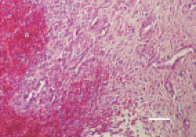 Fig. 2. Resolving haematoma (a) and
fibrous tissue growth (b), H/E, Bar =
35 µm.
