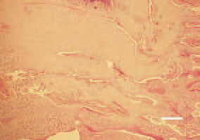 Fig. 1. Longitudinal cross-section,
proximal tibia, broiler chicken. Growth
and buildup of prehypertrophic cartilage.
There is no distinct border between
proliferating and hypertrophic
cartilage. H/E, Bar = 50 µm.