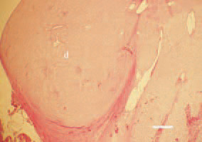 Fig. 3. Subperiosteal dysplasia (d) of
prehypertrophic cartilage in the proximal
tibia region, resulting in bone
deformation. H/E, Bar = 100 µm.