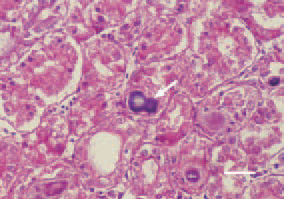 Fig. 1. Visceral gout. Transverse crosssection,
kidney, chicken. Bluish-purple
urate deposits in the lumen of renal
tubules forming urate cylinders (arrows).
H/E, Bar = 25 µm.