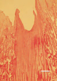 Fig. 4. Abnormal masses of hypertrophic cartilage, protruding
into the epiphysis in rickets, that caused femoral
head necrosis and fracture at later stage. H/E, Bar = 100
µm.