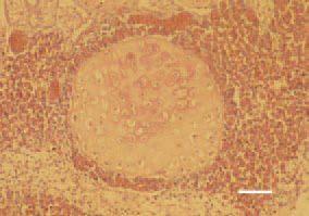 Fig. 1. Cartilaginous or osteocartilaginous
lung nodules are most commonly
encountered in broiler chickens after
the age of 3 weeks. They are divided
into hyaline cartilaginous, mineralized
cartilaginous and osseous. Their
localization is in the parenchyma of
pulmonary lobules at a distance from
large air ducts or blood vessels. The
causes are unknown. The condition
is largely prevalent in chickens having
survived an ascites episode. H/E, Bar
= 30 µm.