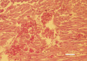 Fig. 1. The right auricle rupture is
characterized by sudden death, generally
in broiler chickens at the age of
10 - 14 days. Macroscopically, haemopericardium,
overfilled vena cava and
rupture at the site of communication
with the auricle are observed. Common
histological findings are the haemorrhages
and degenerative myocardial
lesions. H/E, Bar = 25 µm.