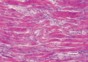 Fig. 1. & Fig. 2. Transverse/londitudinal
cross-section, thigh muscle, chicken,
after intoxication with high doses
maduramycin. Enhanced eosinophilia
and denenerative necrobiotic lesions
of muscle fibres. H/E, Bar = 40 µm.