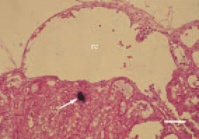 Fig. 5. Urate cylinders (arrow) and retention
cysts (rc) in kidneys. H/E, Bar
= 50 µm.