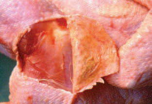 Cullulitis. In the subcutaneous tissue, thick fibrinous plaques are often found out.