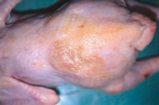 Cellulitis (inflammation of the subcutaneous tissue that affects also the overlying skin). It predominates in broilers and is detected mainly in slaughter-houses. Macroscopically, the lesions are with a yellowish-brown colour.