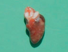 The aetiological agent is S. pullorum, a non-motile Gram-negative microorganism. S. pullorum is very resistant under moderate climatic conditions and could survive for months. It could be killed by fumigation with formaldehyde of breeder eggs in the hatchery. Typical for this form are the greyish-whitish nodes in one or some of the following places: heart (39), lungs, liver, gizzard walls (40) and intestines, the peritoneum.