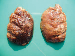 Acute fowl typhoid.
The lungs acquire a characteristic brown colour. Here, necroses and, following their organization, „sarcoma-like nodules