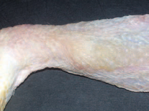 Mycoplasma synoviae (MS) infections could progress as either acute or a chronic systemic disease with symptoms of arthritis, synovitis and bursitis especially in hens and turkeys. The earliest signs are lameness, lying down and retarded growth. Often, oedemas of tibiotarsal joints and the drumstick are observed. The morbidity and death rates are moderate, under 10%. Young chickens at the age of 4-12 weeks and turkey poults at the age of 10-12 weeks are susceptible. Synovites are encountered all year round, but are prevalent during cold humid seasons or when the litter is wet.