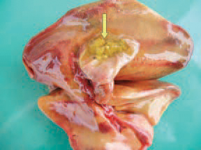 Clostridium perfringens is the aetiological agent. CAH is experimentally reproduced in broilers by ligation of bile ducts and inoculation with CI. perfringens. The gall bladder is filled with a thick bile secretion or a dense matter with a creamy colour.