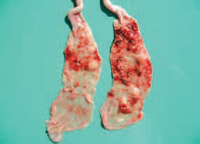 UE is a problem in all world regions with extensive poultry breeding. Young birds are infected more frequently although the disease is also common among adult quails. The early lesions appear like yellowish foci with haemorrhagic boundaries that could be seen from both the serous and the mucosal surfaces.
