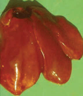 The liver is often enlarged, mottled with necroses of a various size and marginal infarctions. Usually, bile-coloured mucoid enteritis is observed. The arsenics as well as some antibiotics including tylosin, tetracycline and penicillin are effective for treatment of infected birds. The application of vaccines is successful, but the acquired immunity is short and revaccinations are needed.