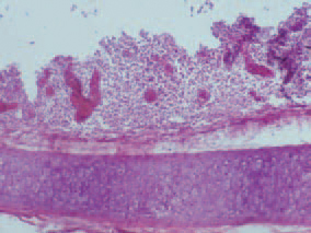 In chickens up to the age of 4 weeks, IB is manifested by severe respiratory signs (sneezing, coughing, and rales). Rhinites and conjunctivites, depression and crowding around heat sources are observed. The death rate could reach 100%. The mortality in young chickens is usually insignificant provided that a secondary infection with a different agent is not occurring. In such cases, there is a moderate to severe inflammatory cell infiltration of upper respiratory tract mucosa, resulting In thickened and more compact mucosa.