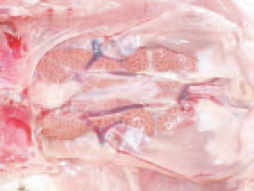 The nephrotropic strains of the IB virus cause severe inflammatory and dystrophic necrobiotic damages of kidneys: urolithiasis (229), interstitial nephritis (230), haemorrhages (231) that considerably increase the death rate. Under natural conditions, only hens are infected. Non-immune birds of all ages are susceptible. The disease is even seen in vaccinated flocks. The serological methods (VN, ELISA etc.) are widely used in the diagnostics. At present, PCR is used for rapid identification of IB virus serotypes. IB should be distinguished from other acute respiratory disease as ND, laryngotracheitis and infectious coryza. The vaccination with live or killed vaccines is effective only if they contain the respective serotype of the virus for the given region.