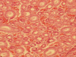 The nephrotropic strains of the IB virus cause severe inflammatory and dystrophic necrobiotic damages of kidneys: urolithiasis (229), interstitial nephritis (230), haemorrhages (231) that considerably increase the death rate. Under natural conditions, only hens are infected. Non-immune birds of all ages are susceptible. The disease is even seen in vaccinated flocks. The serological methods (VN, ELISA etc.) are widely used in the diagnostics. At present, PCR is used for rapid identification of IB virus serotypes. IB should be distinguished from other acute respiratory disease as ND, laryngotracheitis and infectious coryza. The vaccination with live or killed vaccines is effective only if they contain the respective serotype of the virus for the given region.