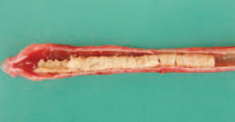 In some cases, casts of haemorrhagic or fibrinous exudate are formed that could almost completely obturate the larynx and the trachea. Source of the infection are sick and convalescent birds, the latter being prolonged carriers of the virus (up to 1 - 2 years). With this regard, a certain stationarity is observed.
