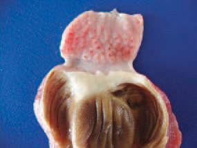 The hyperaemic and haemorrhagic mucous coat of the gizzard is a frequent finding in fusariotoxicoses.
 
