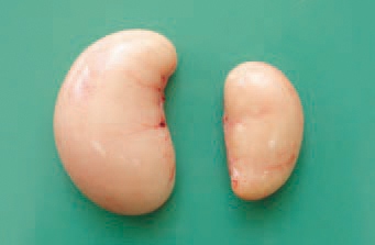 The fusariotoxin zearalenone has an effect, identical to that of oestrogenic hormones and results in reduction of testes in cocks. Left - normal; right - atrophied testis in a cock, in whose diet high zearalenone concentrations have been determined.