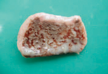 Frequently, the proventriculus is dilated at a various extent, its wall is thickened and in its mucous coat, fibrinous necrotic and haemorrhagic lesions are detected. The prevention from mycotoxicoses requires the detection and control of mycotoxin-contaminated forage components, avoidance of forage moulding and thus, the formation of mycotoxins. A screening of cereals and forages for the presence of some mycotoxins (aflatoxin, T-2 toxin, zearalenone) via ELISA is advised. The application of commercial mycotoxin-binding agents could possibly reduce the effects of some of them. In some mycotoxicoses, the systemic requirements for vitamins, minerals and proteins are increased and they could be balanced by supplementation with forage or water.