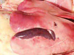 Subcapsular parenchymal haematomas are possible.