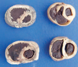 The right ventricle at an early stage is hyper-trophied whereas at a later -dilated with extremely thinned wall (transverse cross sections of fixed heart). The diagnosis is based on gross lesions. The reduction of oxygen requirements by slowing down the metabolism protects from and decreases the incidence of ascitis. Restriction of forage consumption and various light patterns are recommended.