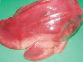 Amyloidosis of internal organs. The buildup is observed mainly in the liver, the spleen and the kidneys. The affected organ is multifold enlarged, with stretched capsule, rounded margins and pale colour. The state is usually seen following severe disturbances in protein metabolisms prolonged and exhausting diseases (tuberculosis etc.).