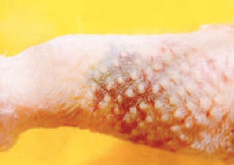 In acute lesions, haemorrhages are visible through the skin. In older lesions, a blue-greenish discoloration is present whereas in chronic lesions, very hard masses as abnormal subcutaneous tissue are palpated.