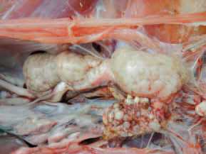 Urolithiasis is an aetiologically unknown state, occurring primarily in cage layer hens, characterized by obstruction of one or both ureters with urates, atrophy of one or more renal lobes and a various degree of renal and visceral gout. A number of aetiological factors are related to this condition: protein excess, calcium excess (3% or more), sodium bi-carbonate toxicity, myco-toxins (ochratoxin etc.), vitamin A deficiency and nephrotropic strains of the infectious bronchitis virus. The lower phosphorus levels (under 0.6%) are probably helping the manifestation of the disease. There are no specific clinical signs except for the depression and the weight loss. The death rate could increase and persist around 2-4% monthly during the productive period. The total mortality is heavily affected flocks could reach 50%.