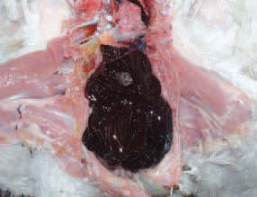 A case of spontaneous rupture of the caudal renal artery in broiler turkeys is observed at the age of 8 - 12 weeks. Some birds in an excellent body condition die. The carcasses are anaemic. The necropsy shows that in some birds, the entire body cavity is filled with clotted blood (538) and in others - massive subcapsular coagula from the side of the affected kidney are detected (539 and 540).