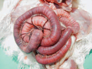 Rotation of the small intestine on the longitudinal axis of the mesentery, resulting in venous stasis and necrosis of the intestinal wall.